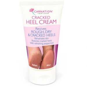 Carnation-Cracked-Heel-Cream