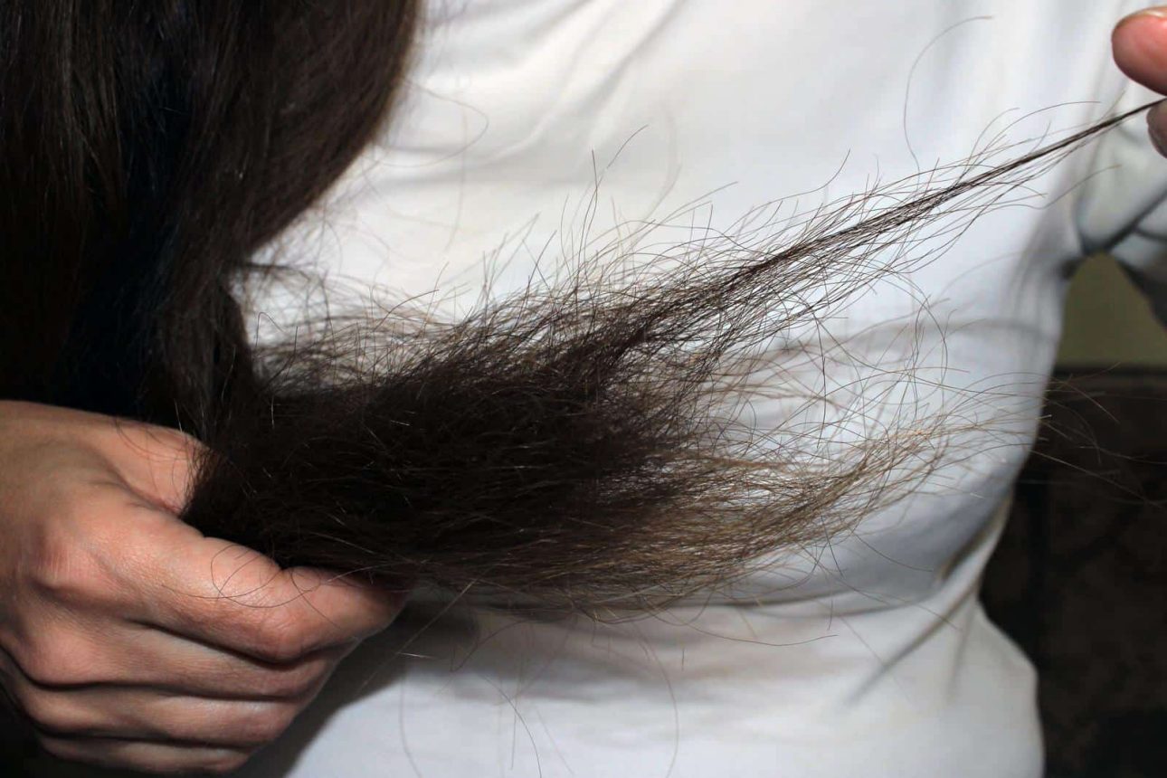 Hair problems in seniors, such as hair loss and curly hair.