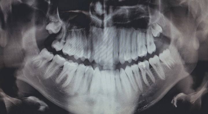 One of the responsibilities of a dental hygienist is taking X-rays and providing personalized dental care. 