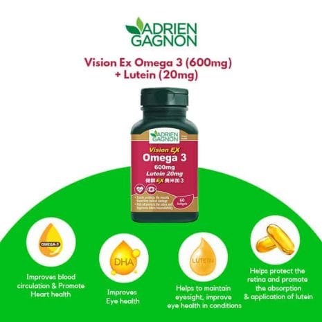 Vision Ex_Overview Vision Ex_Overview